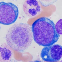 xO Pathology: Hematopathology